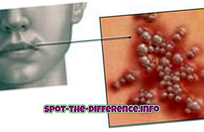 Herpes 1: n ja Herpes 2: n välinen ero
