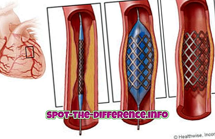 rozdiel medzi: Rozdiel medzi stentom a kardiostimulátorom