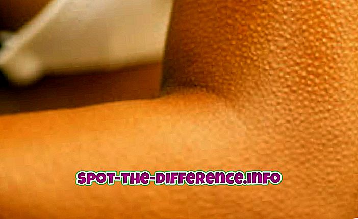 ความแตกต่างระหว่าง: ความแตกต่างระหว่าง Goose Bumps และ Goose Pimples