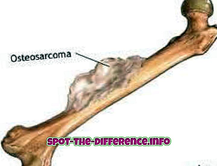 forskel mellem: Forskel mellem sarkom og carcinom