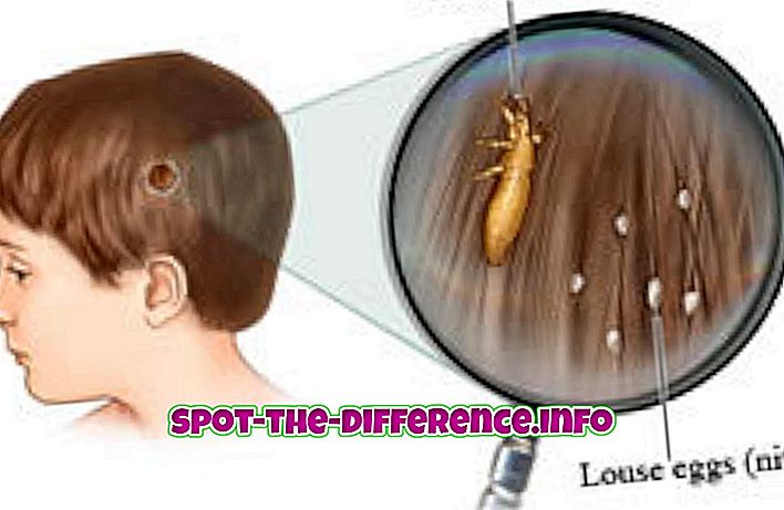 Het verschil tussen Nits en Lice