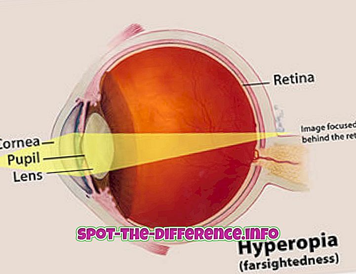 miopia și hipermetropia care este diferența
